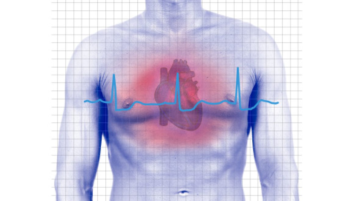 שינוי הגישה לטיפול בפרפור פרוזדורים בחולי אי-ספיקת לב: סקירת עדכון מה-NEJM (שאלת CME)