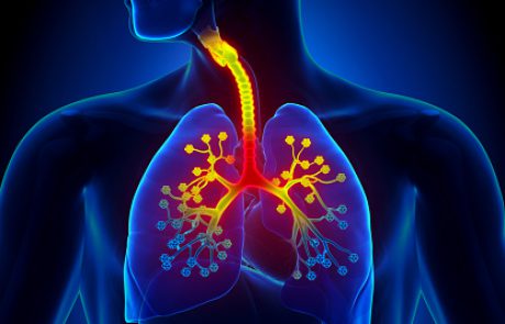 הסקירה החודשית: דלקת ריאות כתוצאה מזיהום במיקופלזמה (CME)