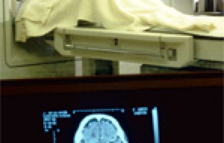 בדיקת CT Angiography של העורקים הכליליים: דיון מקרה מה-JAMA
