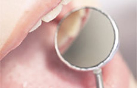 דיון קליני: על גבר בן 25  שלקה בפצעים בפה, פריחה בעור וכאבים בעת הבליעה (CME)